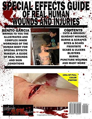 Special Effects Guide Of Real Human Wounds And Injuries 2 Special Effects Guide Of Real Human Wounds And Injuries - Afbeelding 2